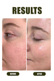 Anti - Pigmentation Kit - Ophelia