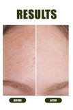 Natural Whitening Kit - Ophelia