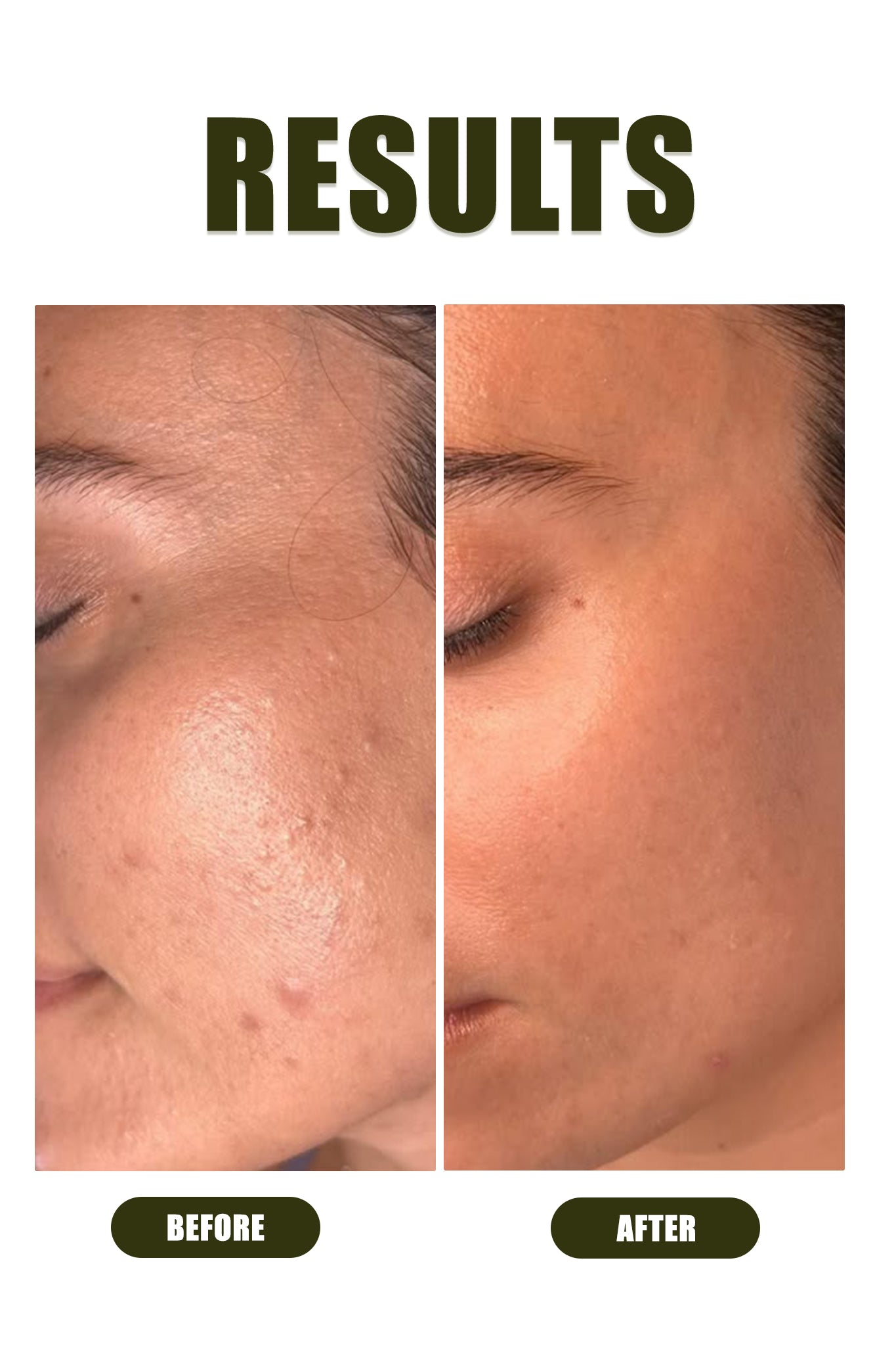 Advanced Botox Alternative Serum - Ophelia