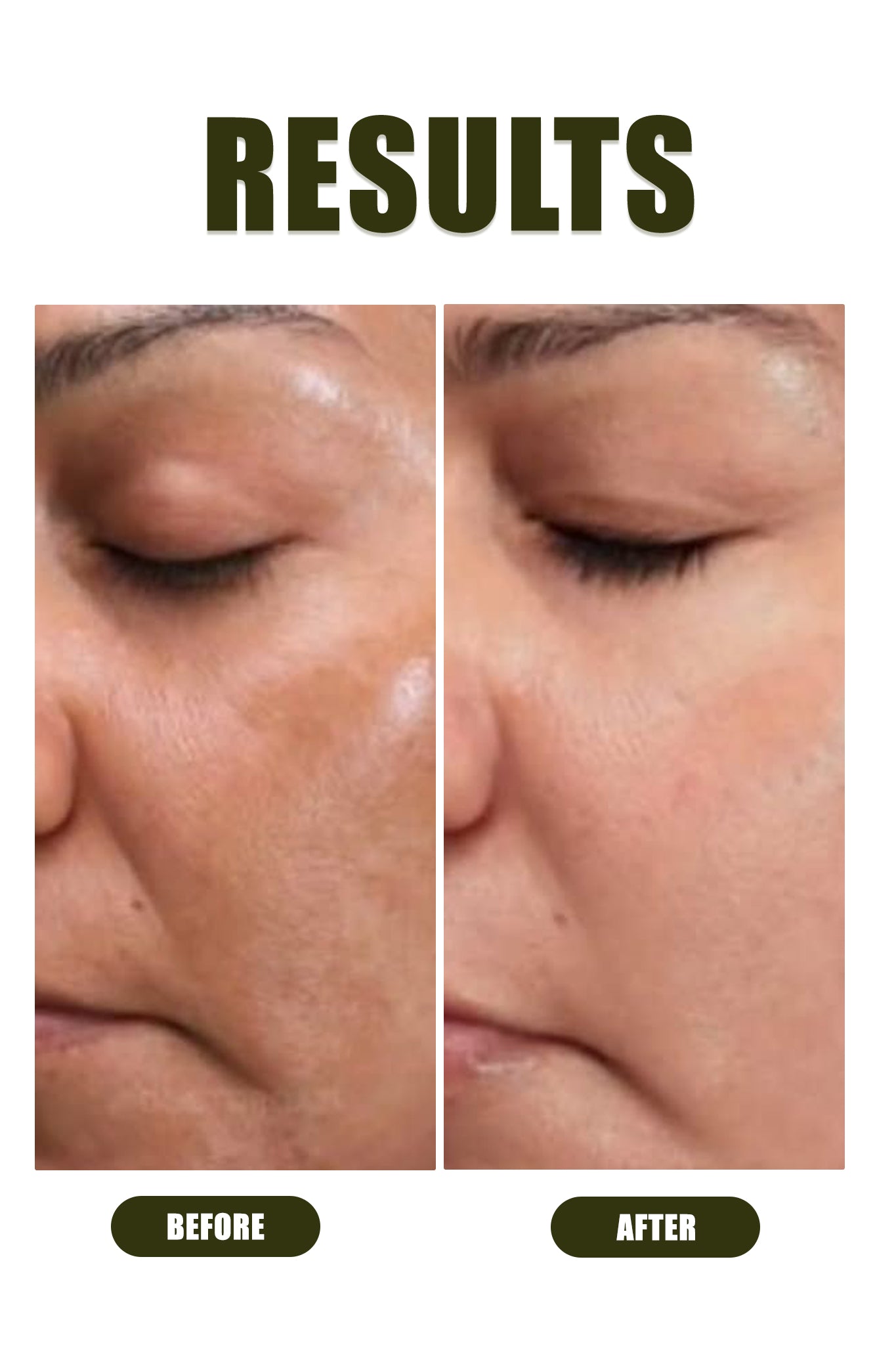 Daily Glow Kit - Ophelia