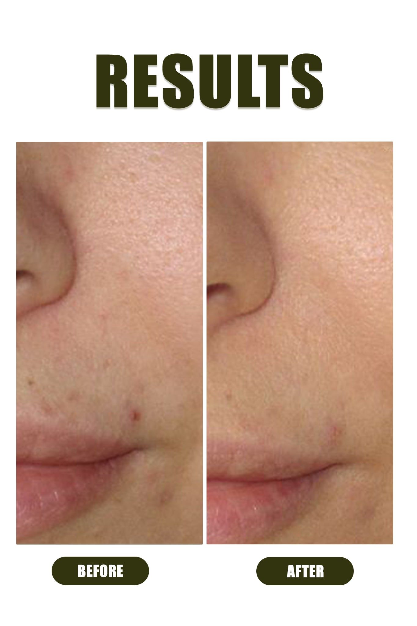 Ophelia Complexion+ - Ophelia