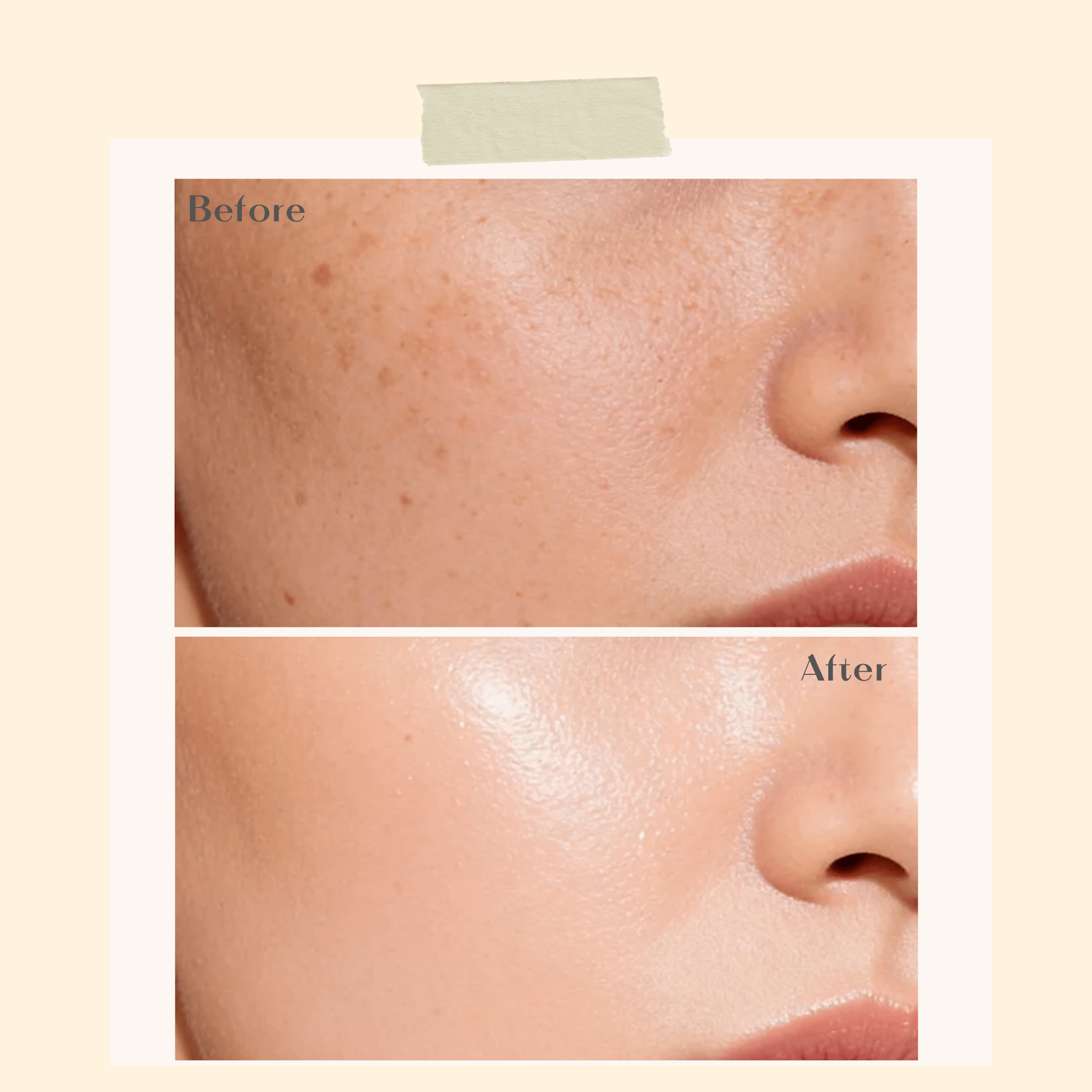 Flash Brightening Serum - Ophelia