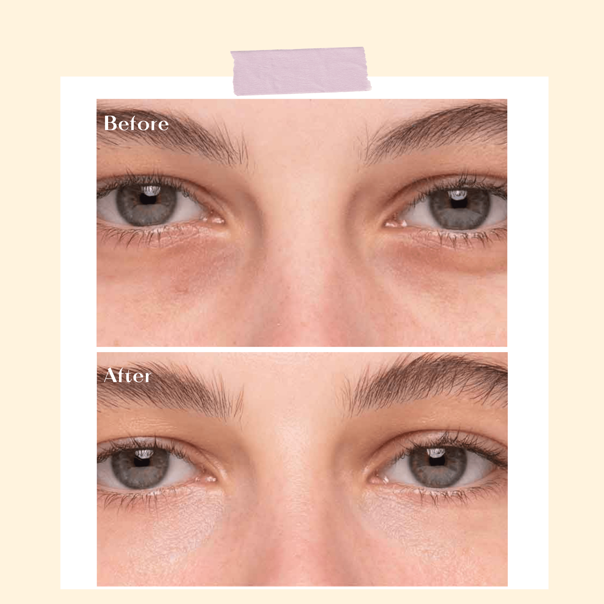 Insta Defence Eye Gel - Ophelia